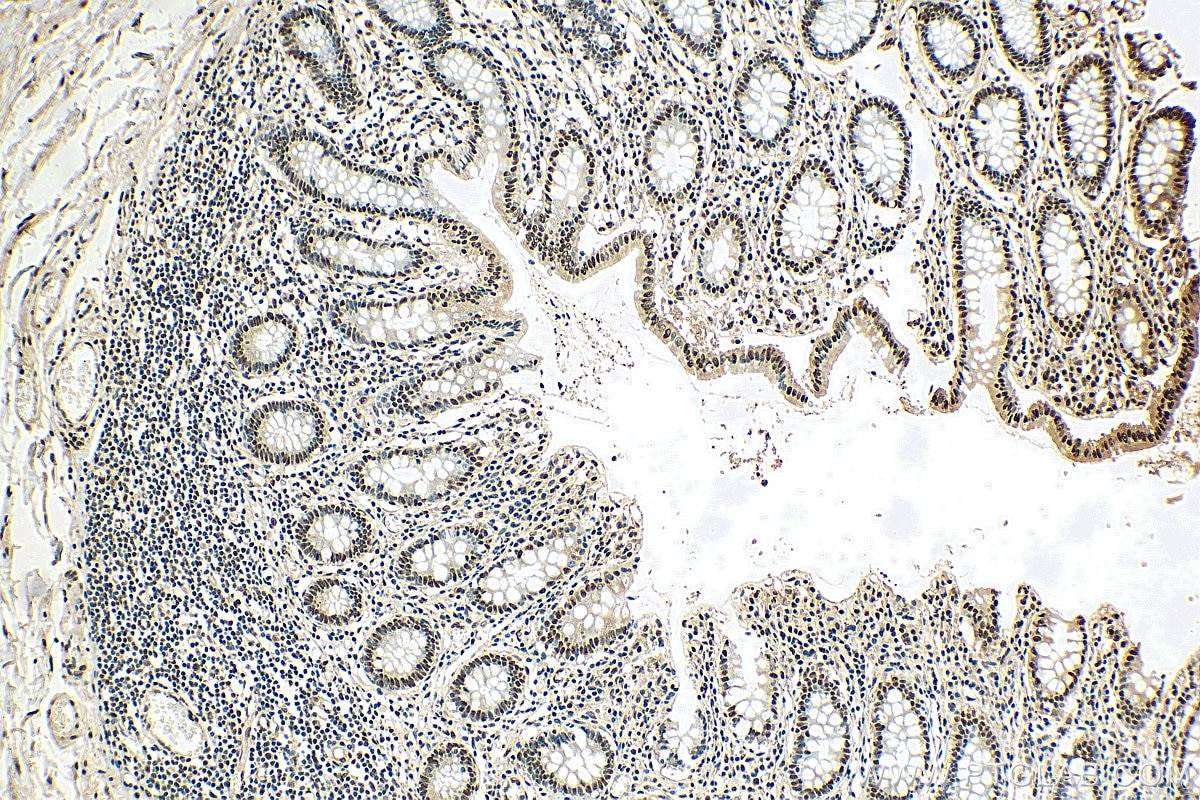 Immunohistochemistry (IHC) staining of human colon tissue using SNRPA Polyclonal antibody (10212-1-AP)