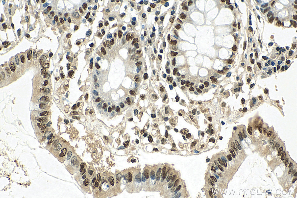 Immunohistochemistry (IHC) staining of human colon tissue using SNRPA Polyclonal antibody (10212-1-AP)