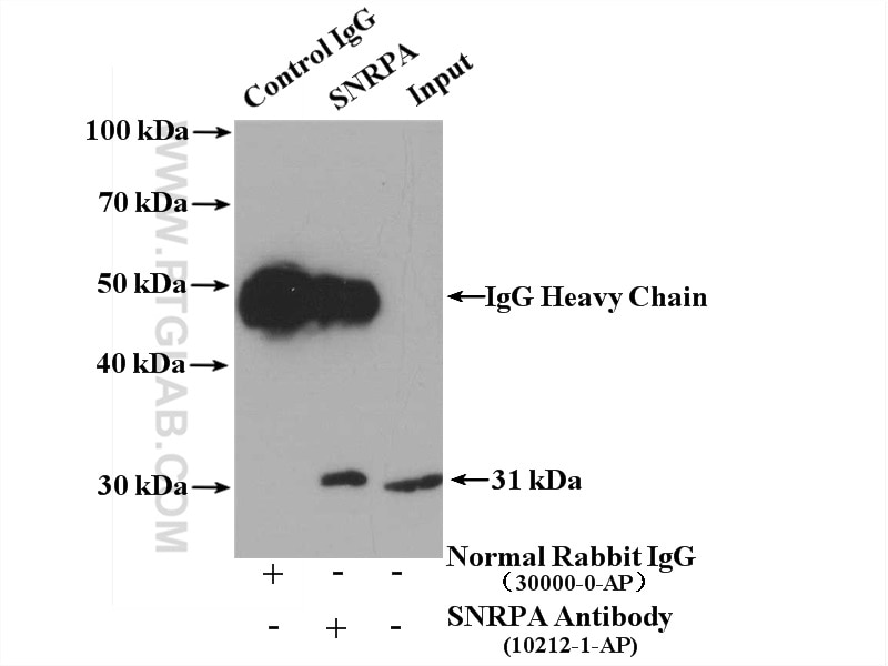Immunoprecipitation (IP) experiment of HEK-293 cells using SNRPA Polyclonal antibody (10212-1-AP)