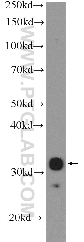 WB analysis of MCF-7 using 10212-1-AP