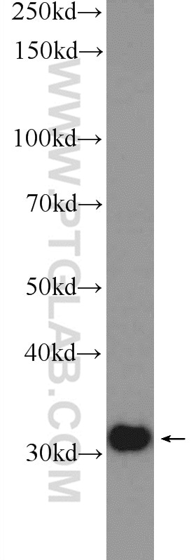 WB analysis of HeLa using 10212-1-AP