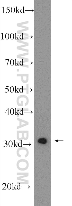 Western Blot (WB) analysis of A431 cells using SNRPA Polyclonal antibody (10212-1-AP)