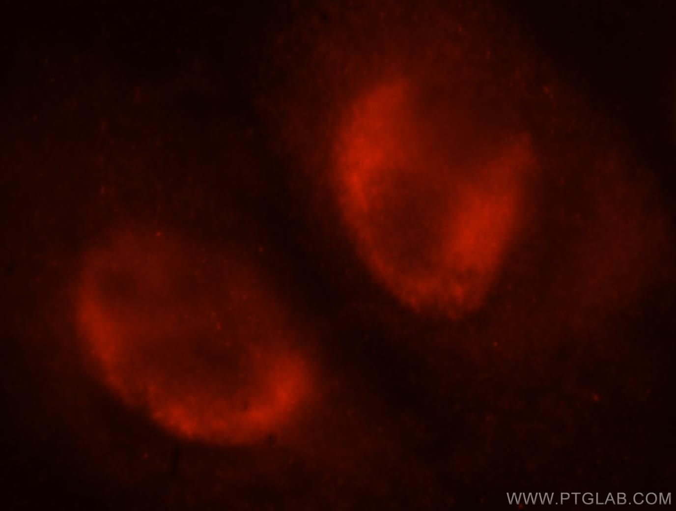 Immunofluorescence (IF) / fluorescent staining of HepG2 cells using SNRPA1 Polyclonal antibody (17368-1-AP)