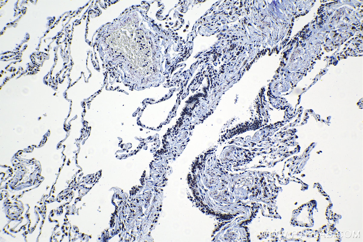Immunohistochemistry (IHC) staining of human lung tissue using SNRPA1 Polyclonal antibody (17368-1-AP)