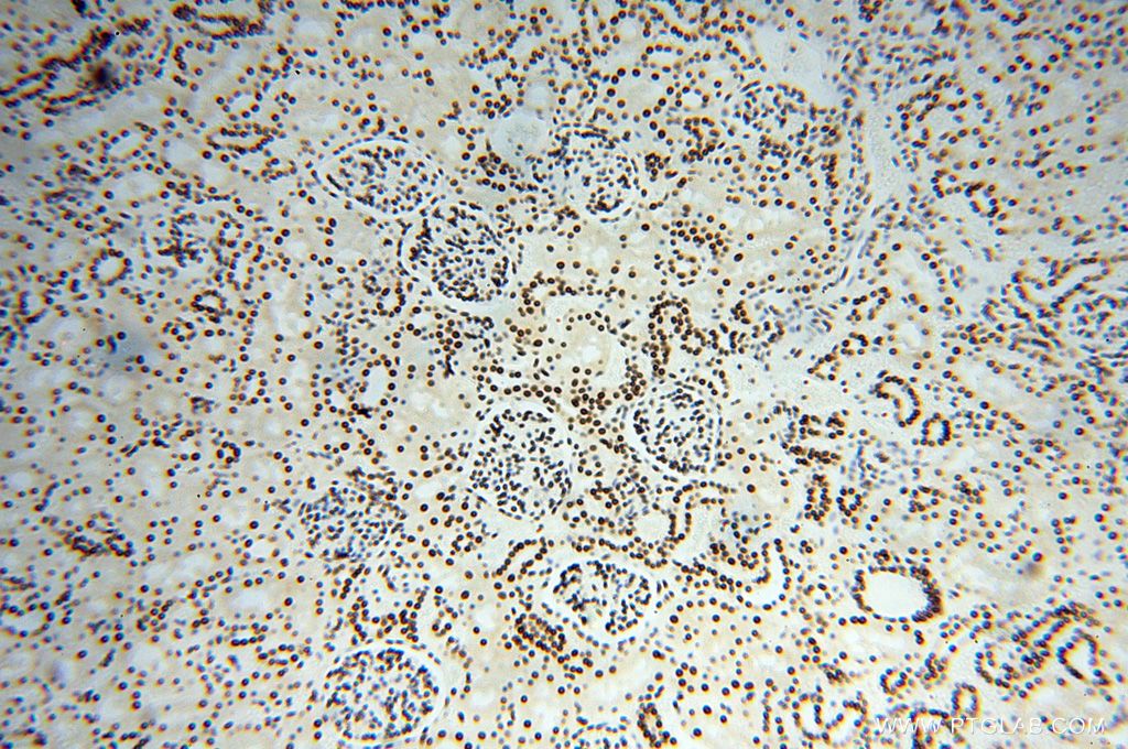 Immunohistochemistry (IHC) staining of human kidney tissue using SNRPA1 Polyclonal antibody (17368-1-AP)