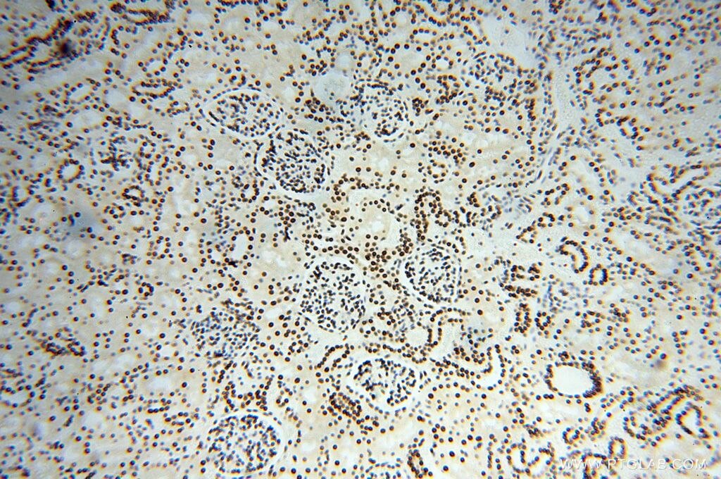 Immunohistochemistry (IHC) staining of human kidney tissue using SNRPA1 Polyclonal antibody (17368-1-AP)