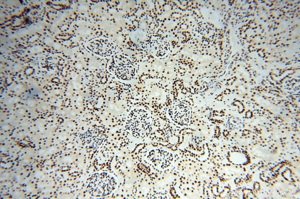 Immunohistochemistry (IHC) staining of human kidney tissue using SNRPA1 Polyclonal antibody (17368-1-AP)