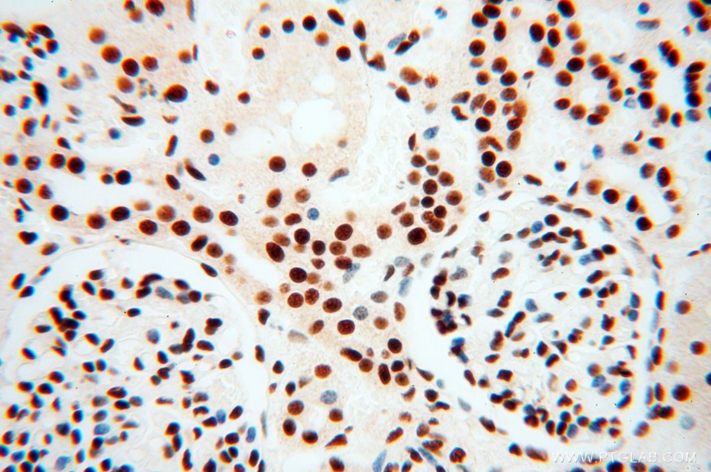 Immunohistochemistry (IHC) staining of human kidney tissue using SNRPA1 Polyclonal antibody (17368-1-AP)