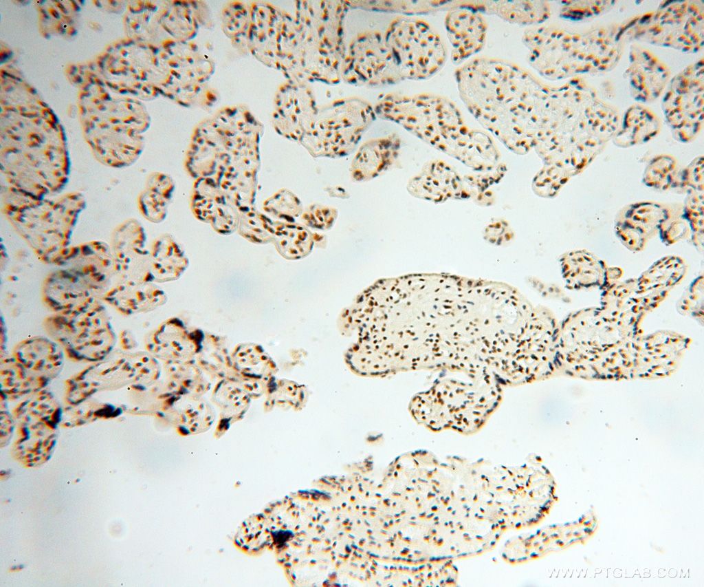 IHC staining of human placenta using 17368-1-AP