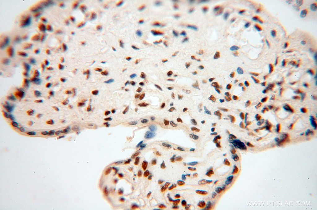 IHC staining of human placenta using 17368-1-AP