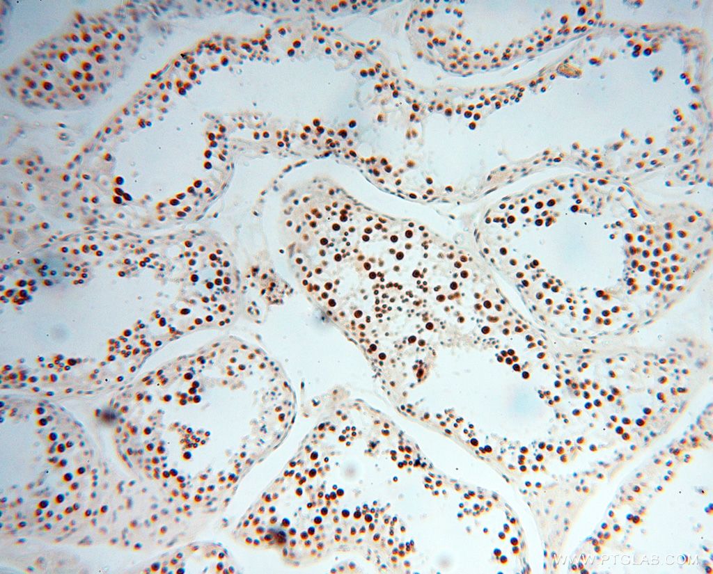 IHC staining of human testis using 17368-1-AP