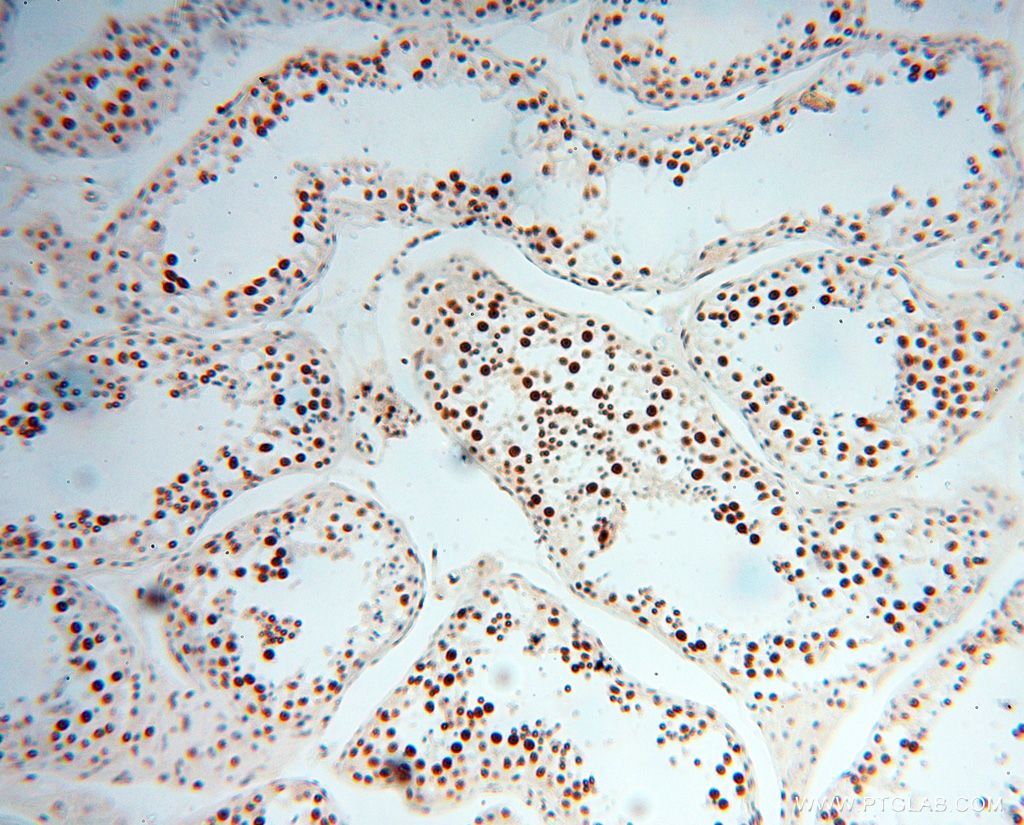 Immunohistochemistry (IHC) staining of human testis tissue using SNRPA1 Polyclonal antibody (17368-1-AP)