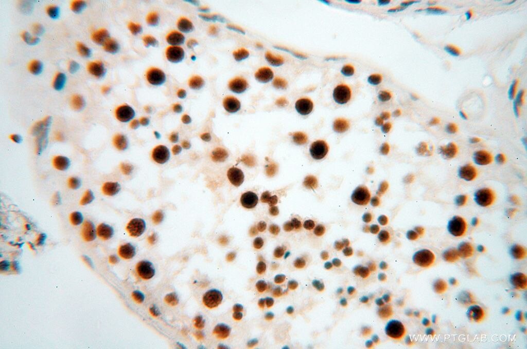 Immunohistochemistry (IHC) staining of human testis tissue using SNRPA1 Polyclonal antibody (17368-1-AP)