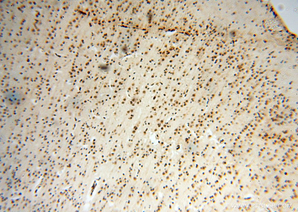 Immunohistochemistry (IHC) staining of human brain tissue using SNRPA1 Polyclonal antibody (17368-1-AP)