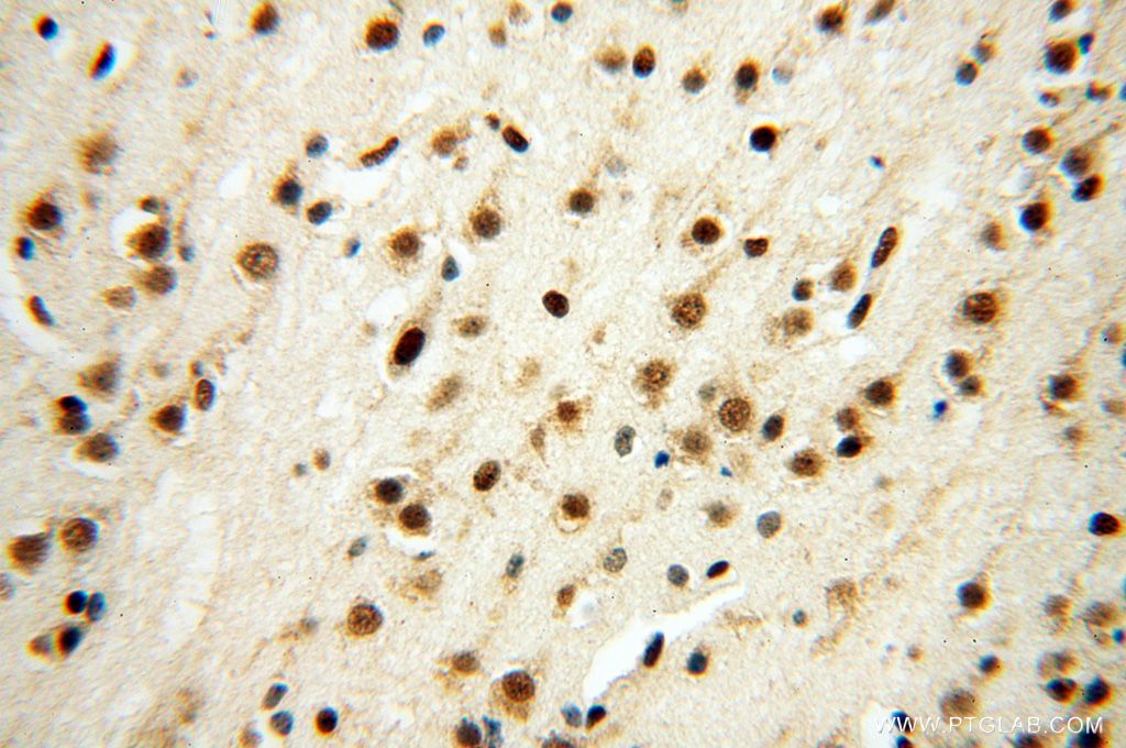 Immunohistochemistry (IHC) staining of human brain tissue using SNRPA1 Polyclonal antibody (17368-1-AP)