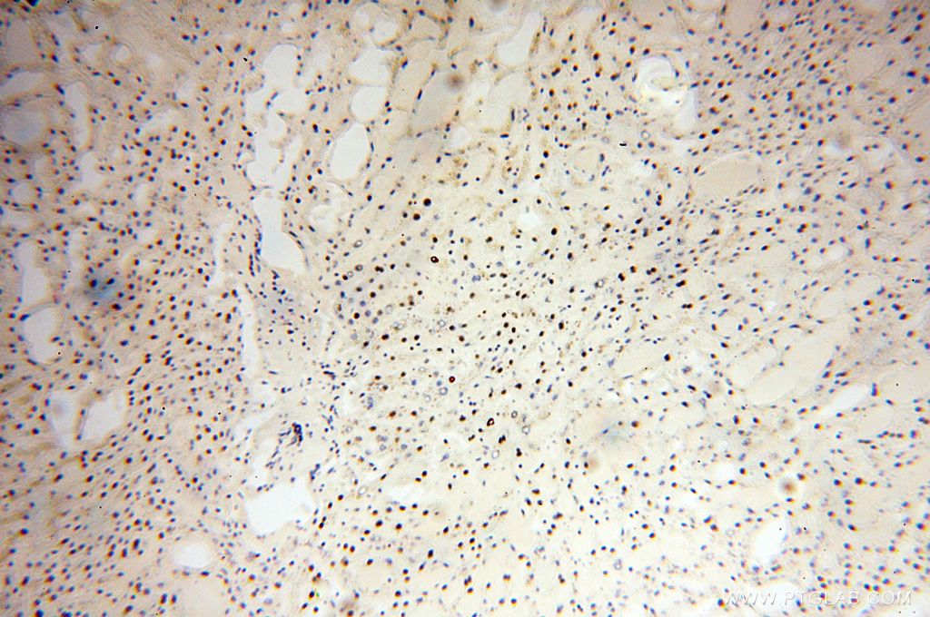 Immunohistochemistry (IHC) staining of human liver tissue using SNRPA1 Polyclonal antibody (17368-1-AP)