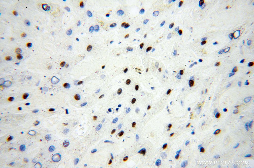 Immunohistochemistry (IHC) staining of human liver tissue using SNRPA1 Polyclonal antibody (17368-1-AP)