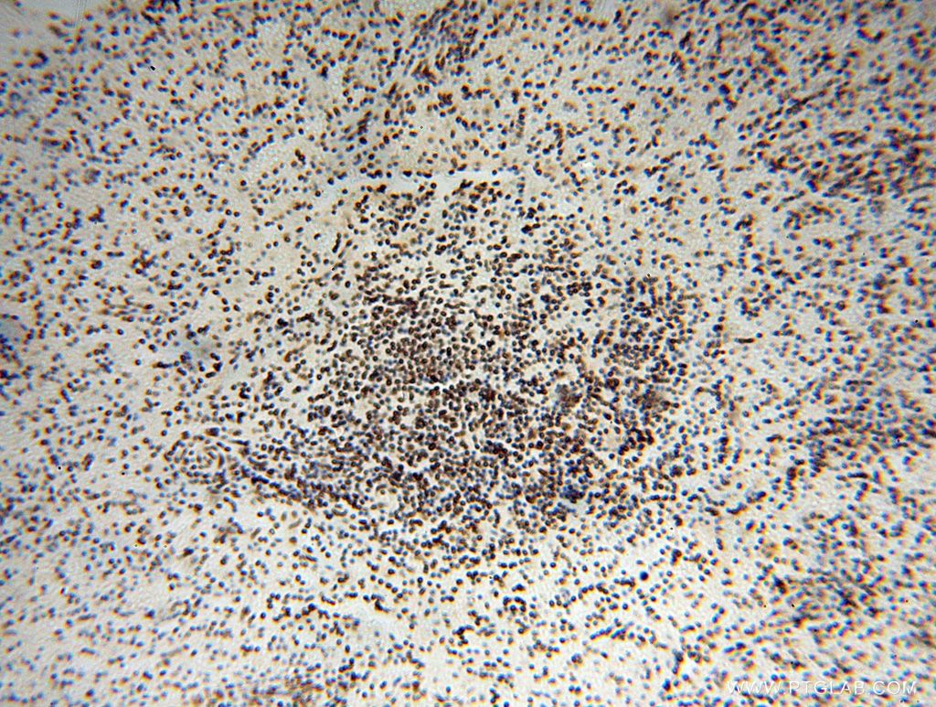 Immunohistochemistry (IHC) staining of human spleen tissue using SNRPA1 Polyclonal antibody (17368-1-AP)