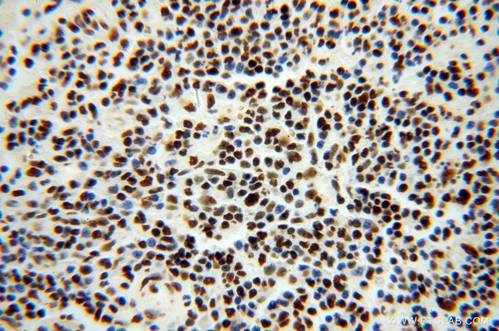 Immunohistochemistry (IHC) staining of human spleen tissue using SNRPA1 Polyclonal antibody (17368-1-AP)