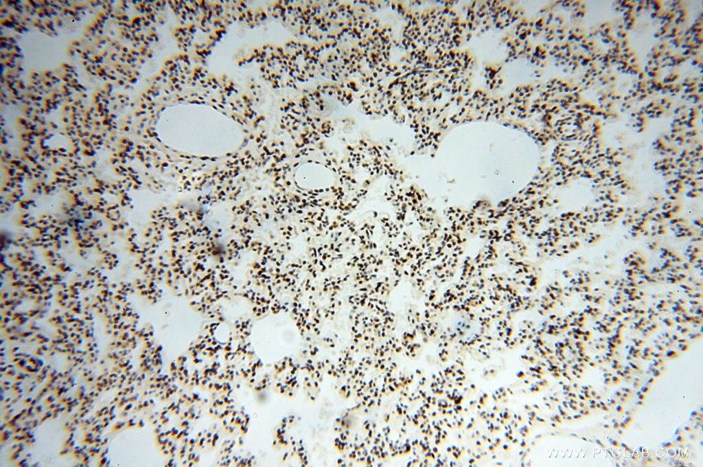 Immunohistochemistry (IHC) staining of human lung tissue using SNRPA1 Polyclonal antibody (17368-1-AP)