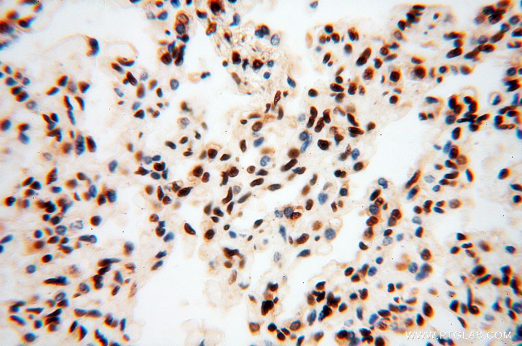 Immunohistochemistry (IHC) staining of human lung tissue using SNRPA1 Polyclonal antibody (17368-1-AP)