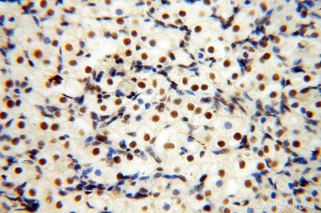 Immunohistochemistry (IHC) staining of human ovary tissue using SNRPA1 Polyclonal antibody (17368-1-AP)