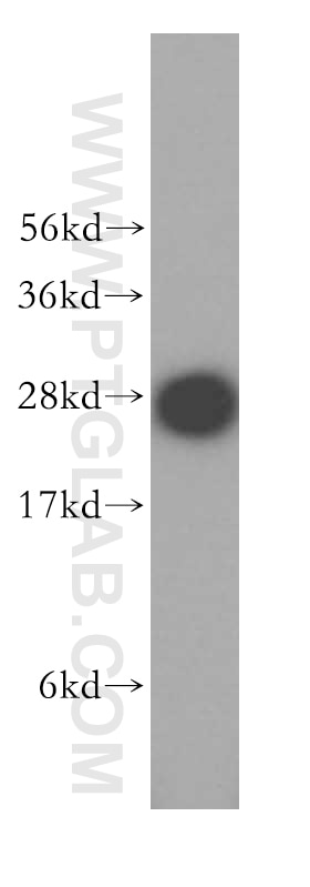 Western Blot (WB) analysis of HeLa cells using SNRPA1 Polyclonal antibody (17368-1-AP)