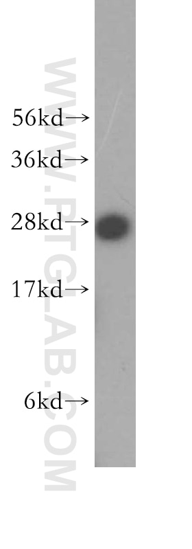 Western Blot (WB) analysis of Raji cells using SNRPA1 Polyclonal antibody (17368-1-AP)