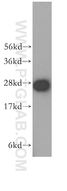 Western Blot (WB) analysis of HepG2 cells using SNRPA1 Polyclonal antibody (17368-1-AP)