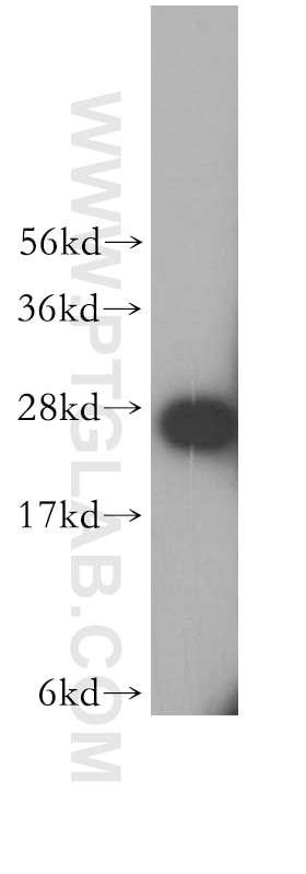 Western Blot (WB) analysis of Jurkat cells using SNRPA1 Polyclonal antibody (17368-1-AP)