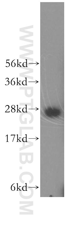 Western Blot (WB) analysis of MCF-7 cells using SNRPA1 Polyclonal antibody (17368-1-AP)
