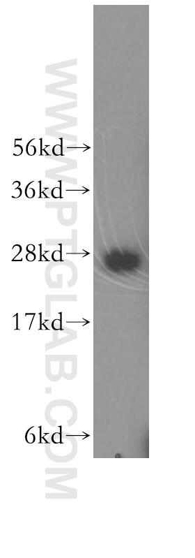 WB analysis of MCF-7 using 17368-1-AP