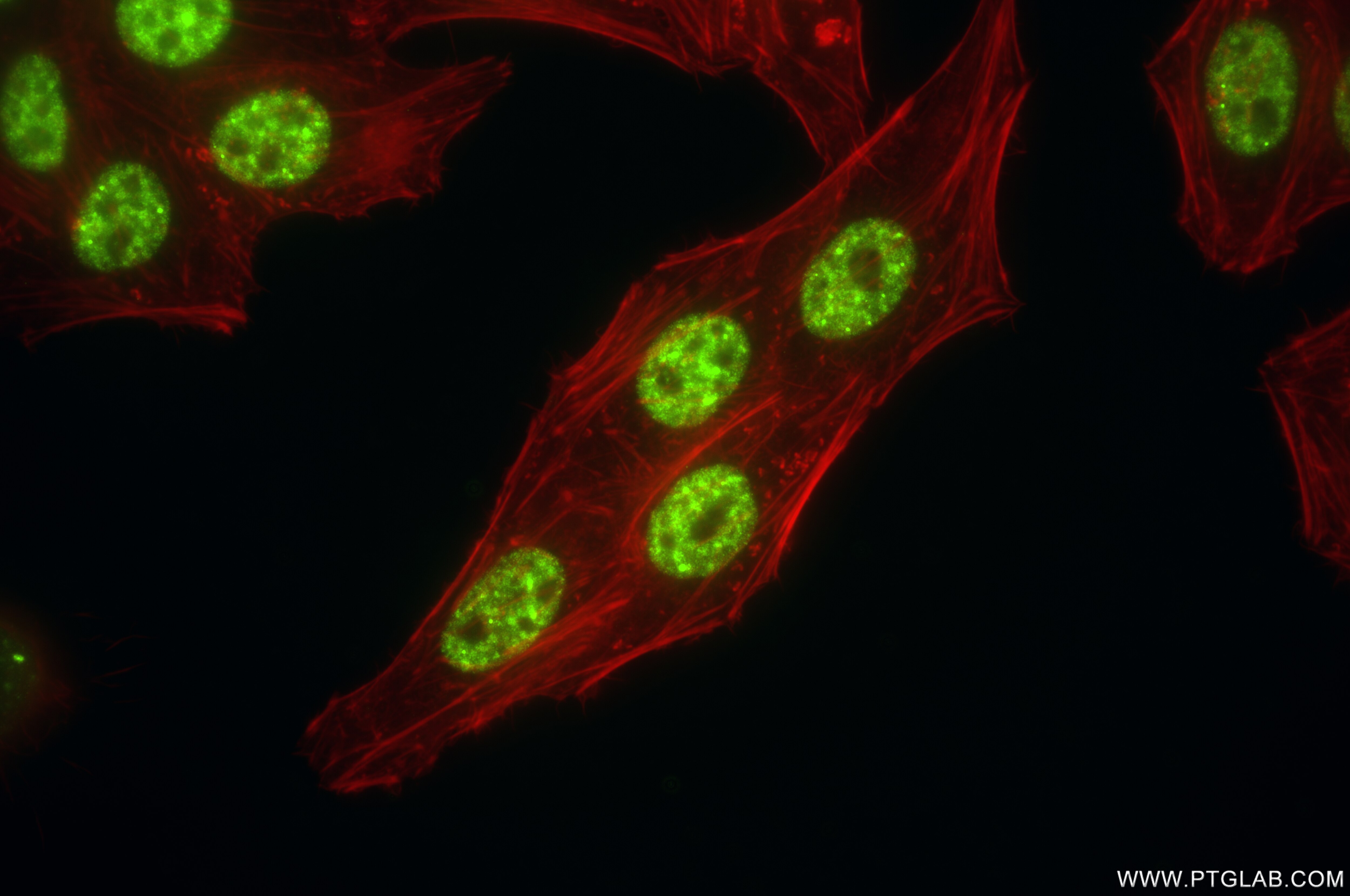 Immunofluorescence (IF) / fluorescent staining of HepG2 cells using SNRPA1 Recombinant antibody (85649-2-RR)