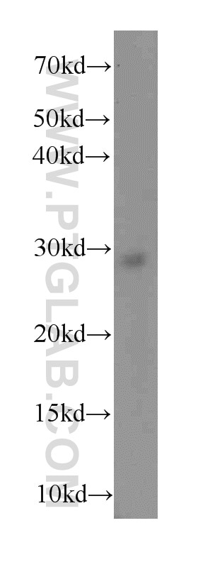 Western Blot (WB) analysis of Jurkat cells using SNRPB Polyclonal antibody (16807-1-AP)