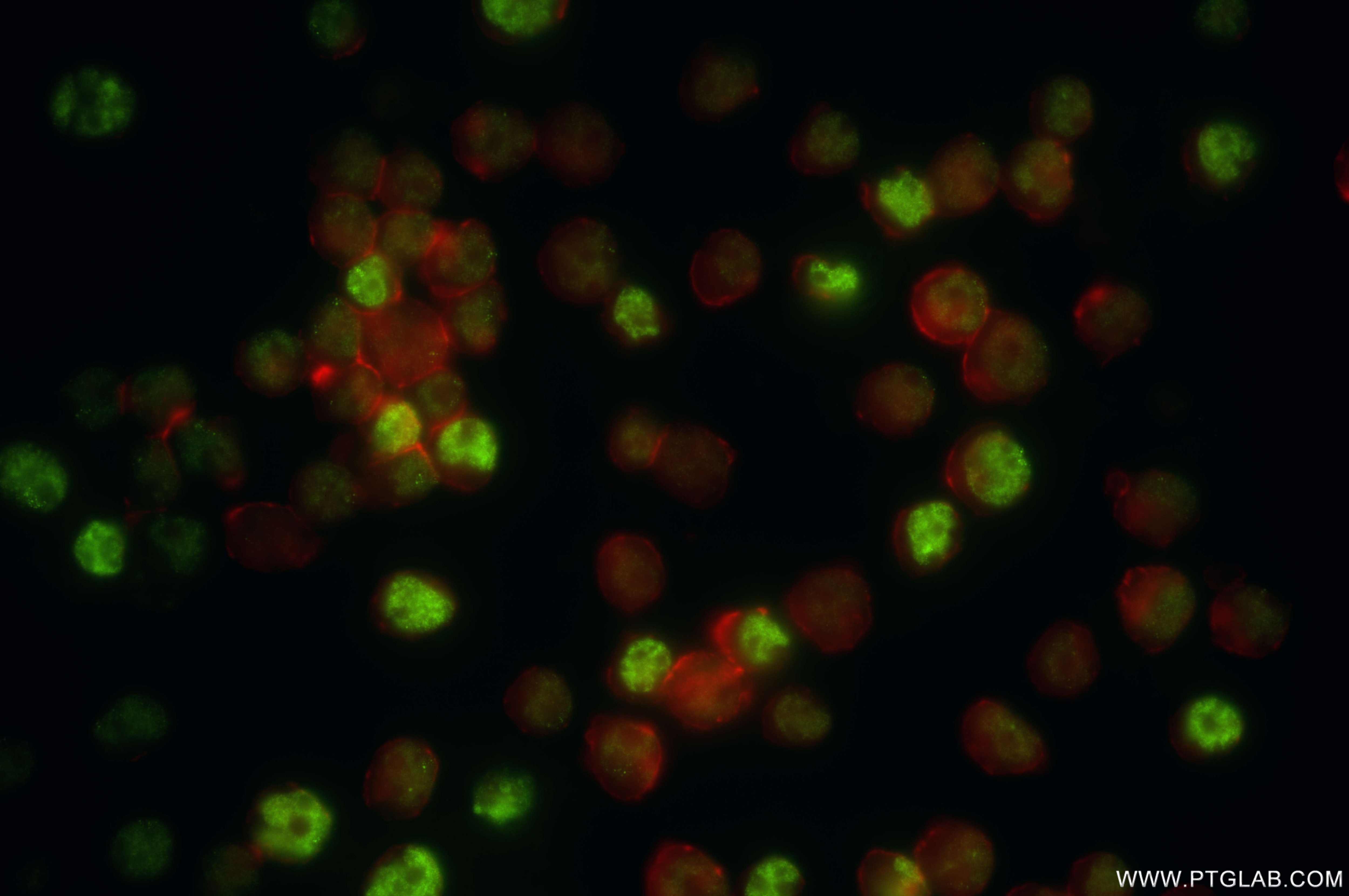 Immunofluorescence (IF) / fluorescent staining of Jurkat cells using SNRPB Recombinant antibody (86099-1-RR)