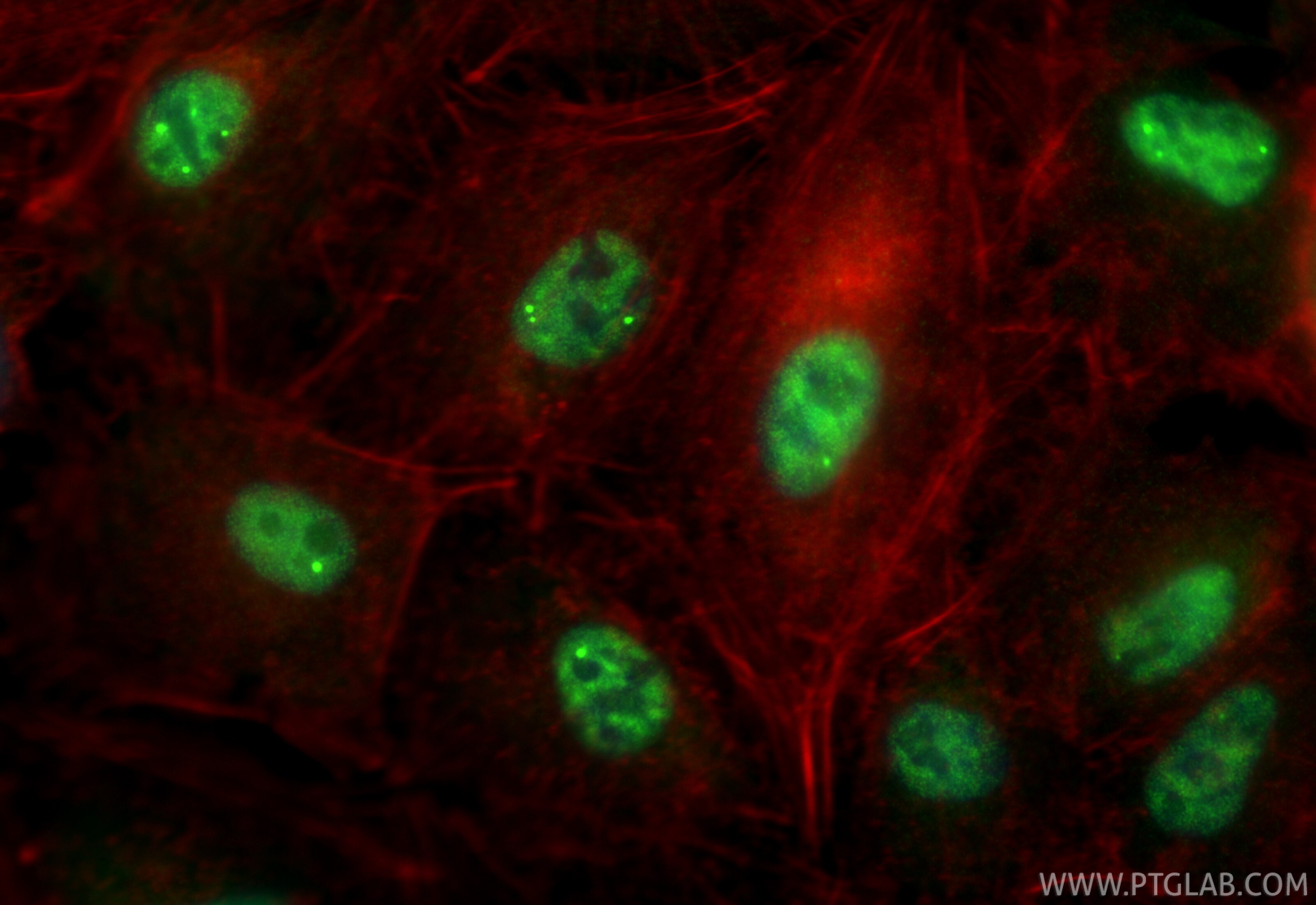 Immunofluorescence (IF) / fluorescent staining of A549 cells using SNRPB Recombinant monoclonal antibody (86099-1-RR)