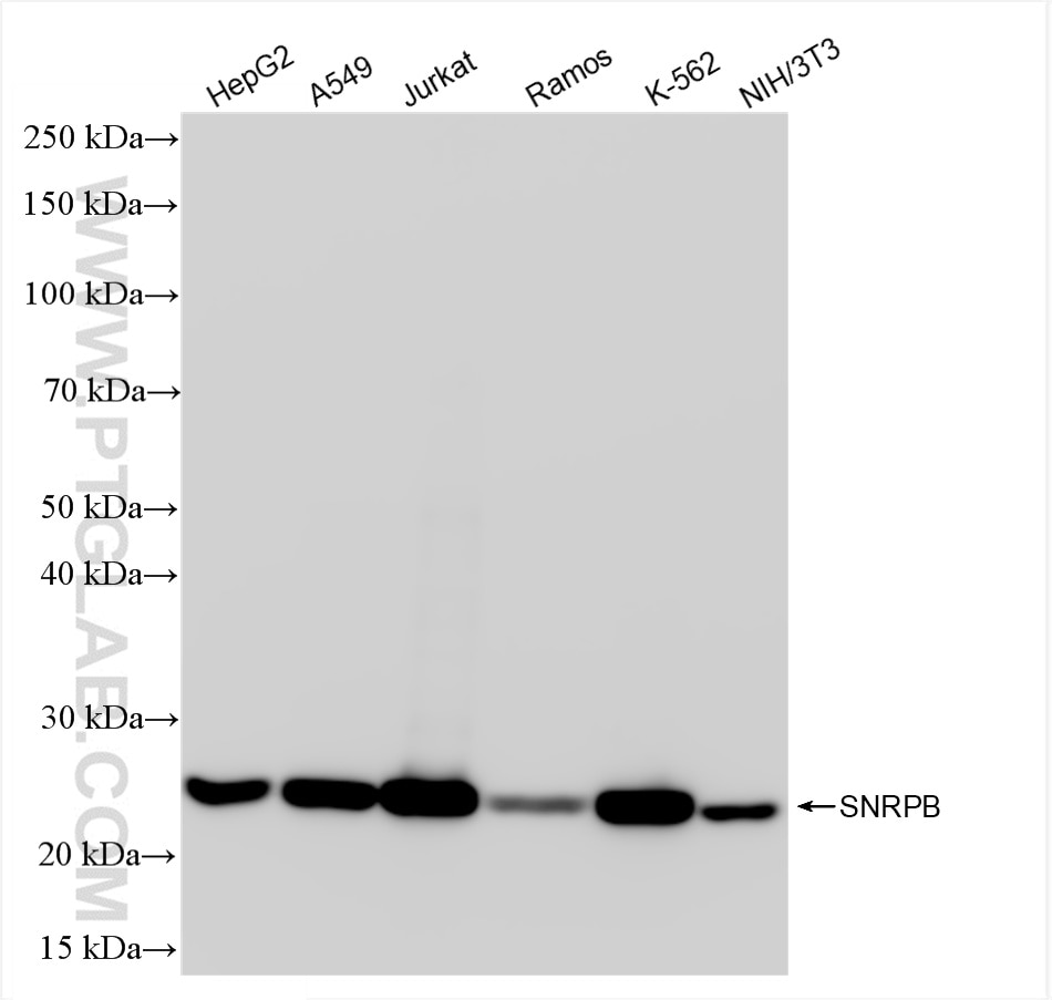 Western Blot (WB) analysis of various lysates using SNRPB Recombinant antibody (86099-1-RR)