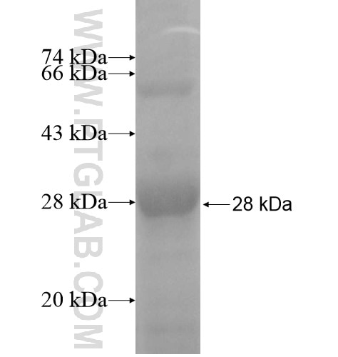 SNRPB fusion protein Ag10298 SDS-PAGE