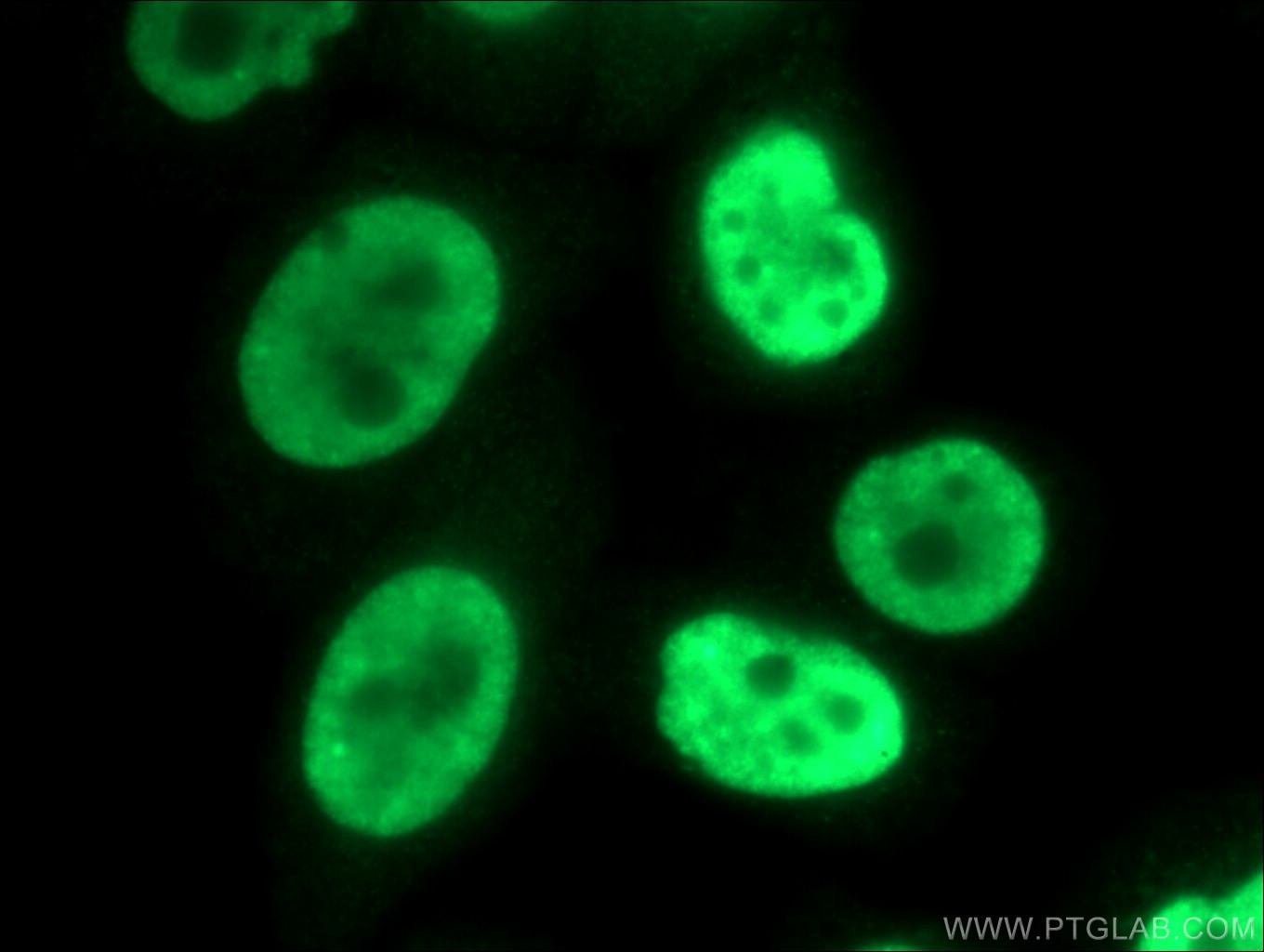 Immunofluorescence (IF) / fluorescent staining of HeLa cells using SNRPB2 Polyclonal antibody (13512-1-AP)
