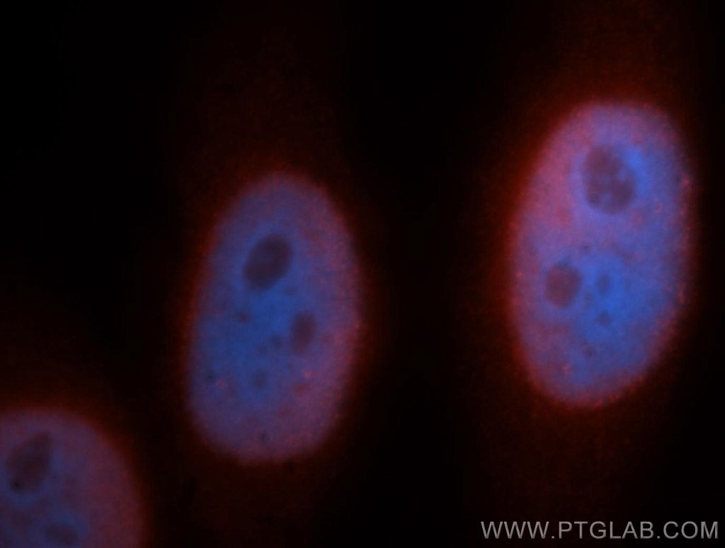 Immunofluorescence (IF) / fluorescent staining of HeLa cells using SNRPB2 Polyclonal antibody (13512-1-AP)