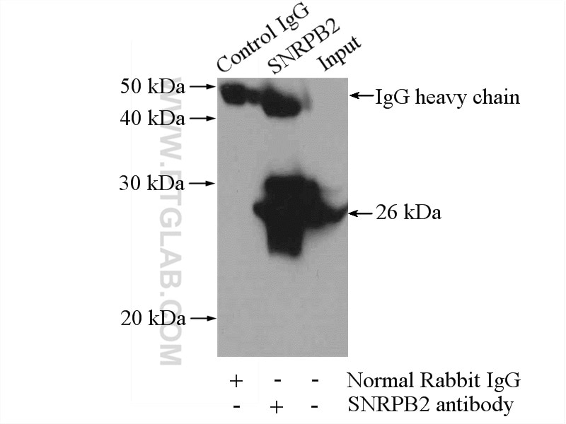 Immunoprecipitation (IP) experiment of mouse liver tissue using SNRPB2 Polyclonal antibody (13512-1-AP)