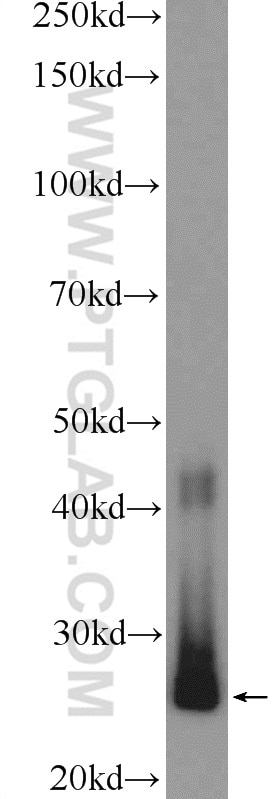 WB analysis of mouse liver using 13512-1-AP