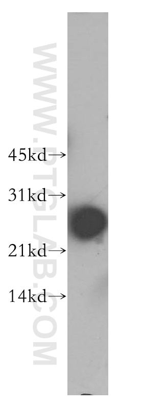 Western Blot (WB) analysis of human kidney tissue using SNRPB2 Polyclonal antibody (13512-1-AP)