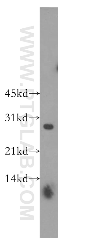 Western Blot (WB) analysis of human liver tissue using SNRPB2 Polyclonal antibody (13512-1-AP)