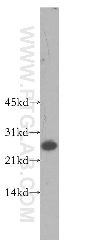 Western Blot (WB) analysis of human brain tissue using SNRPB2 Polyclonal antibody (13512-1-AP)