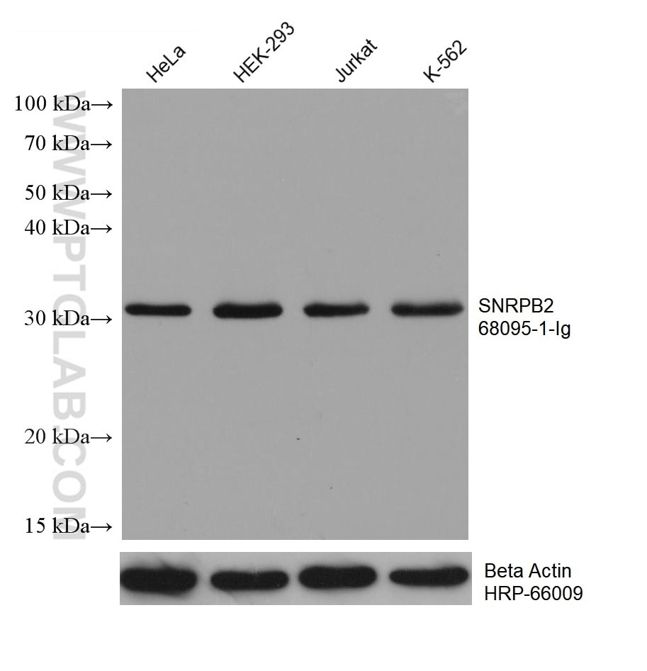 Western Blot (WB) analysis of various lysates using SNRPB2 Monoclonal antibody (68095-1-Ig)