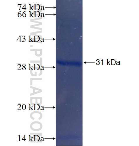 SNRPB2 fusion protein Ag5540 SDS-PAGE