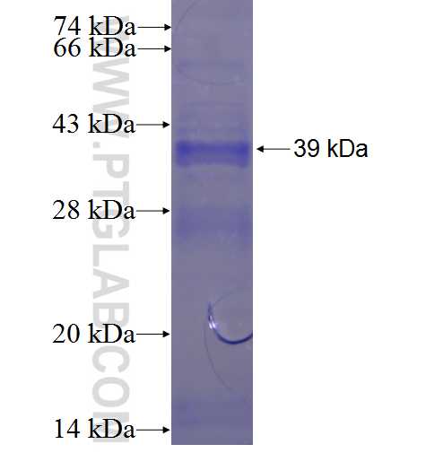 SNRPD1 fusion protein Ag0364 SDS-PAGE