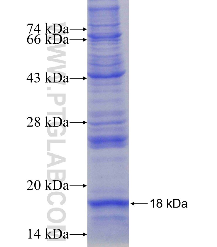 SNRPD1 fusion protein Ag16331 SDS-PAGE