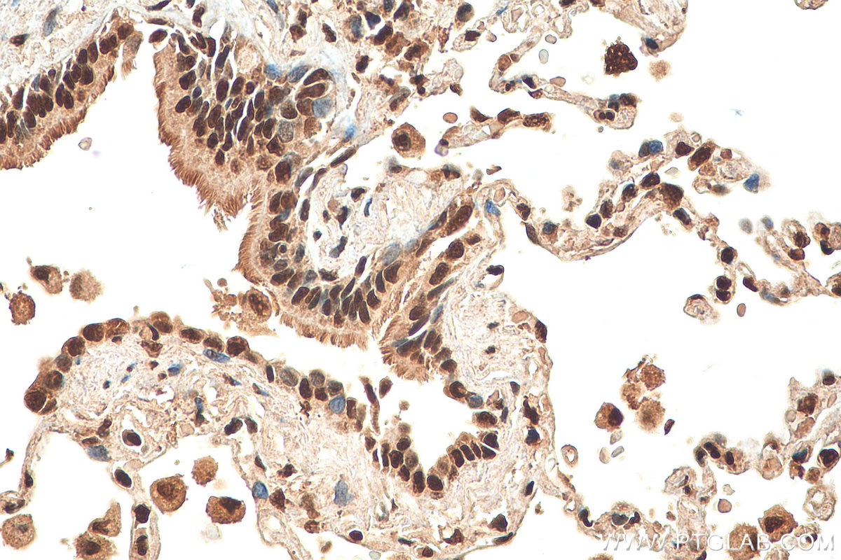Immunohistochemistry (IHC) staining of human lung tissue using SNRPD2 Polyclonal antibody (14789-1-AP)